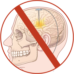 Brain