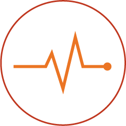 EKG