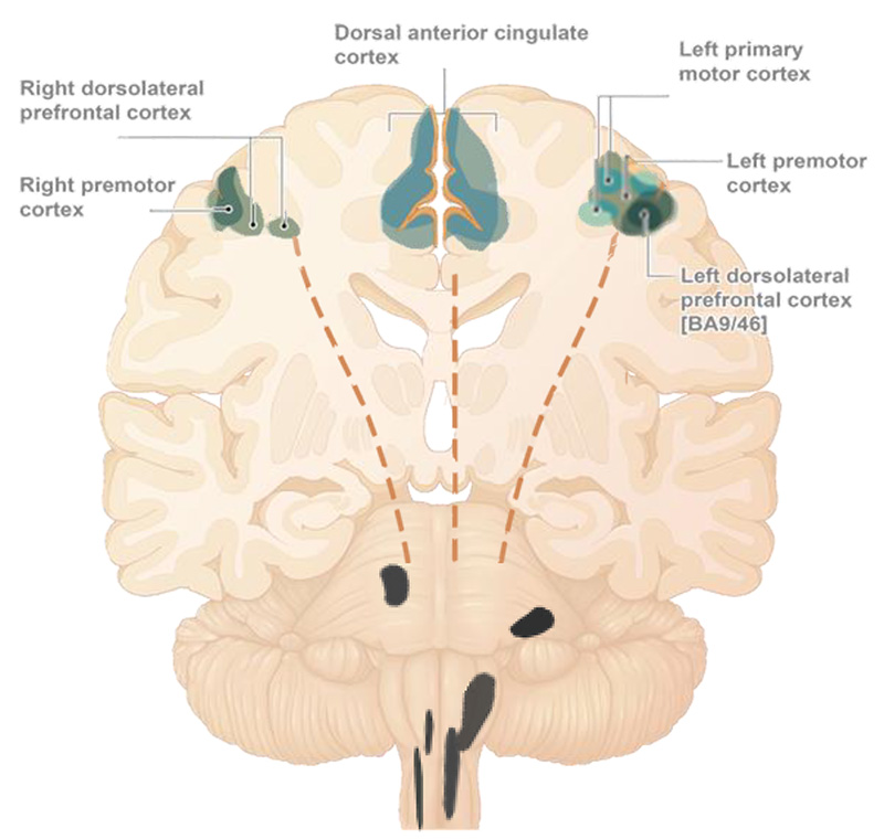 Neuromodulation